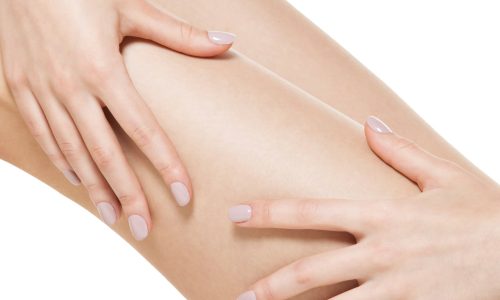 woman-squeezes-cellulite-skin-on-leg-D4QTN5C
